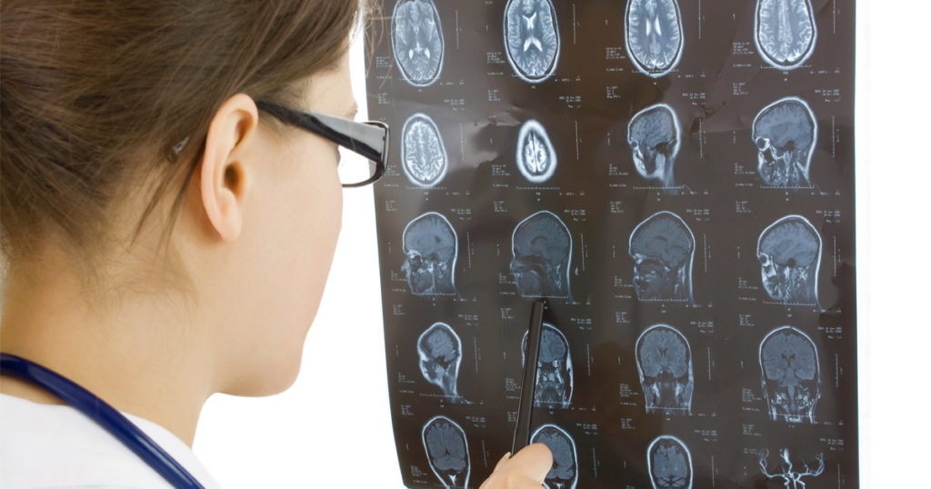 Head & Brain Injuries Slip & Fall Accidents | Nerenberg Law Associates